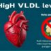Entenda o VLDL e os Riscos de Níveis Elevados para a Saúde Cardiovascular